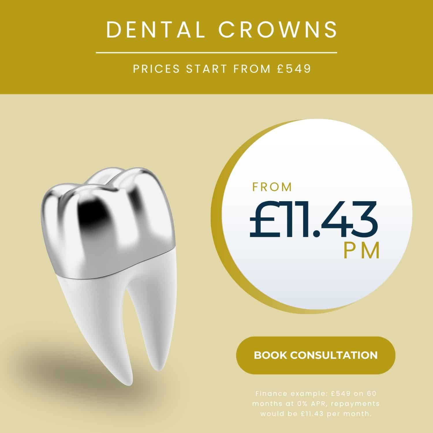 Dental crowns