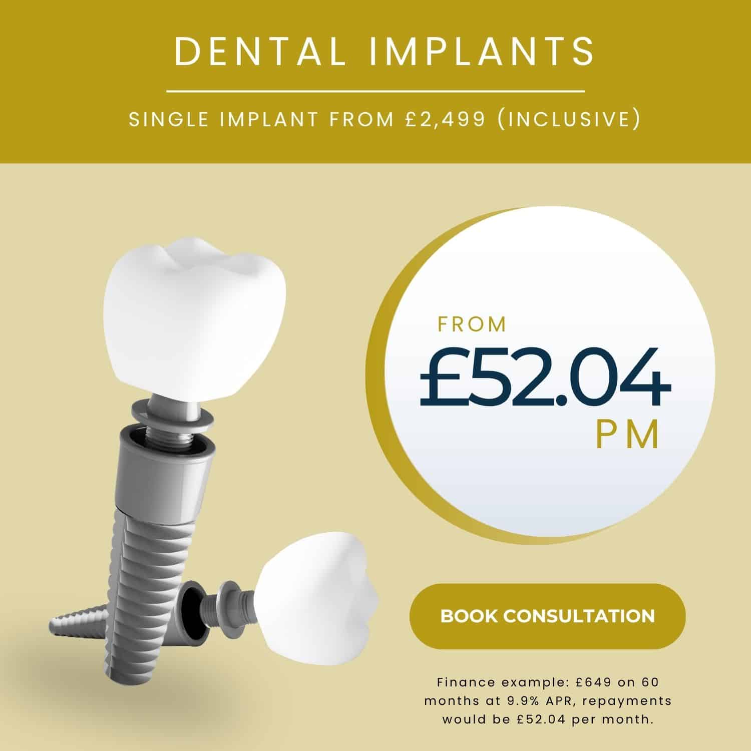Dental implants cost